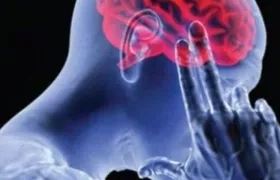 Ilustración accidente cerebral vascular