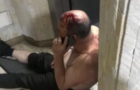 Este es el vigilante herido en los hechos en Bogotá.