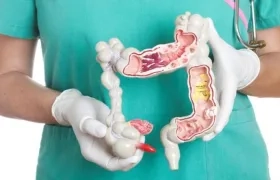 Este padecimiento es el segundo tipo de cáncer que cobra la vida de hombres y el tercero en mujeres.