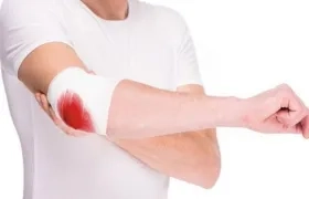 La hemofilia es una enfermedad hereditaria.