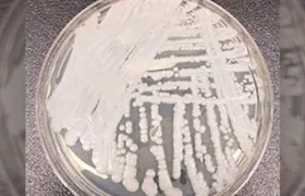 La Cándida auris apareció en 2015 y tiene vigilancia en Colombia desde el año 2016.