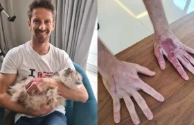 Romain Grosjean muestra cómo quedaron sus manos tras el accidente. 