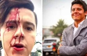 Así quedó el actor tras el ataque.