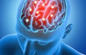  Entre las enfermedades más comunes del cerebro están la migraña, la enfermedad cerebrovascular, la epilepsia y el alzhéimer..