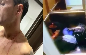 El periodista Juan Fernando Barona y el ataque a su expareja.