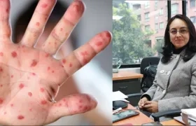 Claudia Cuéllar, directora de Epidemiología del Ministerio de Salud, explicó lo que se sabe de este virus.