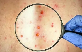 Imagen de referencia.