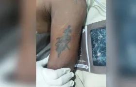 Brazo izquierdo del paciente