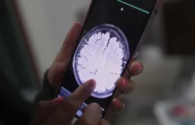 El procedimiento lo realizó un equipo de científicos de la Northwestern University