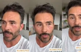 El actor Juan Pablo Raba narrando el hecho.