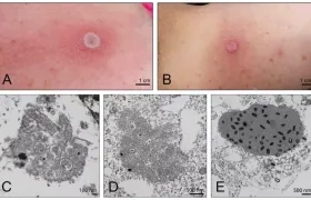 Imágenes referenciales del virus Alaska.