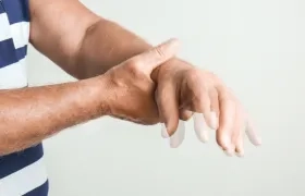 Enfermedad de Parkinson. 