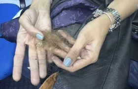 Resultaron con quemaduras en la piel, las manos y el cabello. 