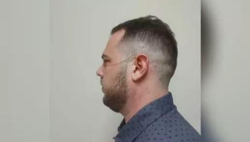 John Poulos presenta marcas de rasguños en su cara y cuello.
