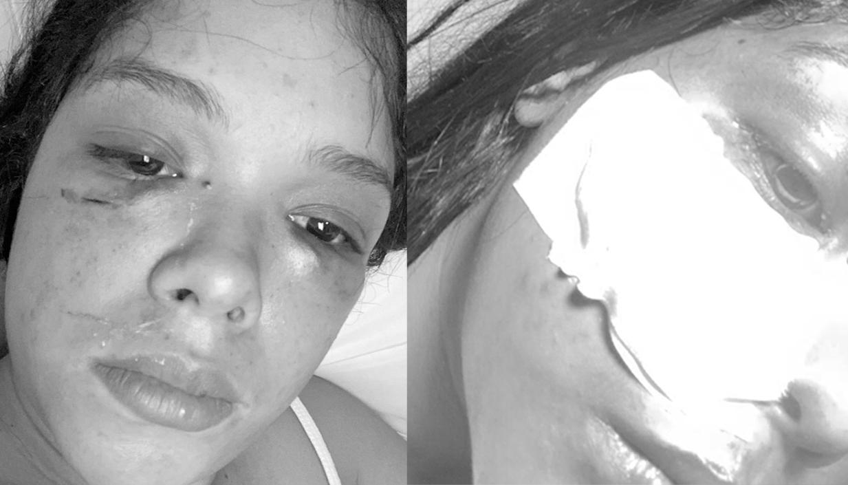Así quedó la mujer tras la violenta agresión de su pareja. 