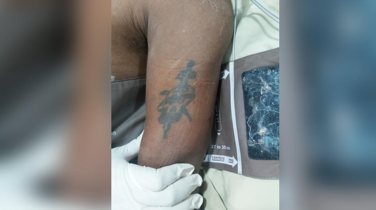 Brazo izquierdo del paciente