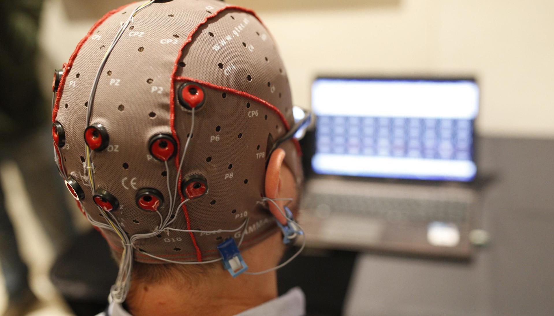 Imagen de archivo de un tratamiento cerebral
