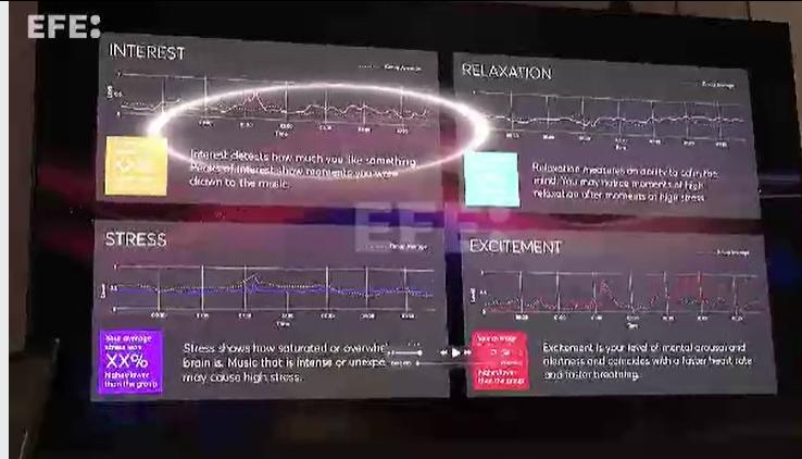 Diferentes estados del cerebro a medida que se escucha a Pink Floyd