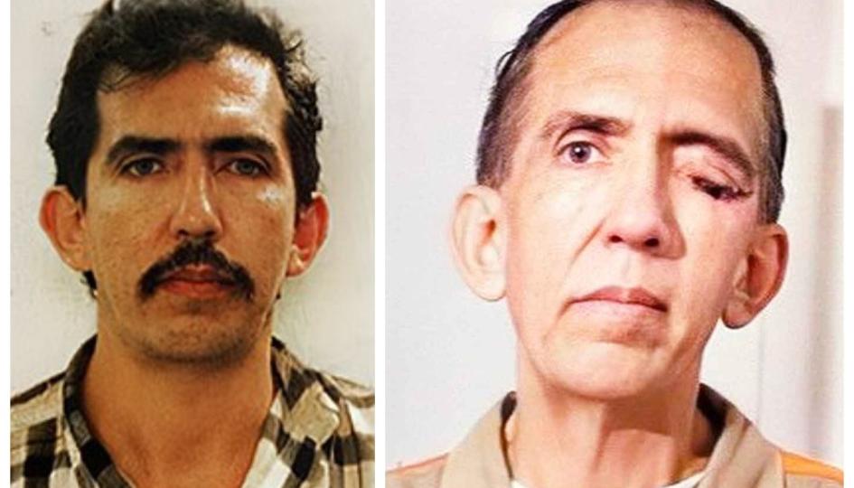 Tras su cáncer de ojo la apariencia de Luis Garavito cambió notablemente. 