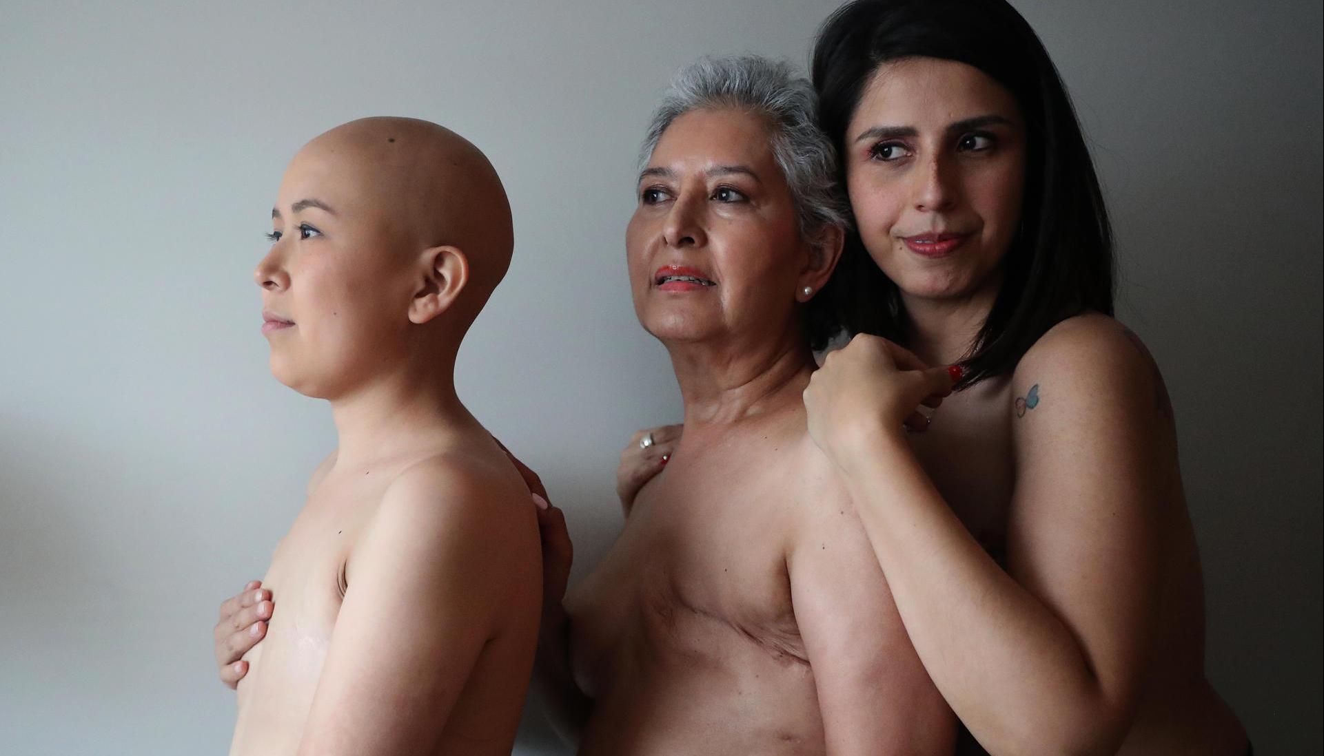 Lorena Estrada, Angeles Arreola y Sandra Monrroy, pacientes con cáncer de mama.