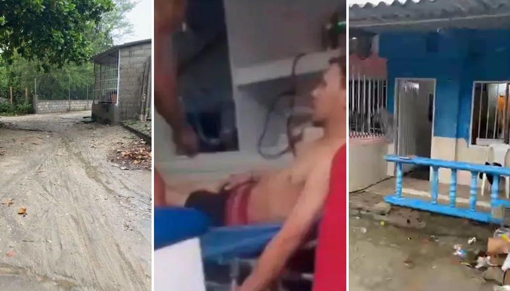 Una de las personas heridas por el rayo que cayó en Santa Marta