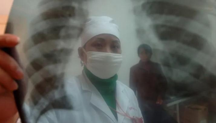 Imagen diagnóstica de pulmones