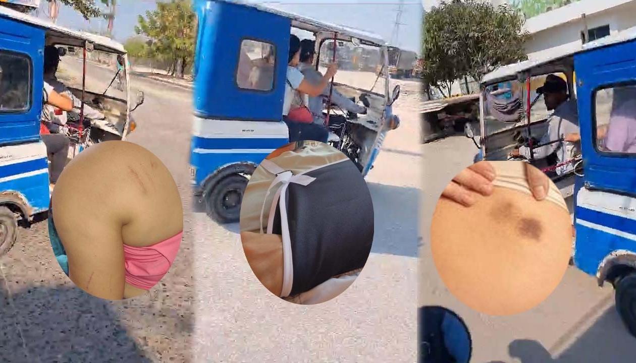 Una de las pasajeras tuvo que recibir atención médica por sus heridas. 