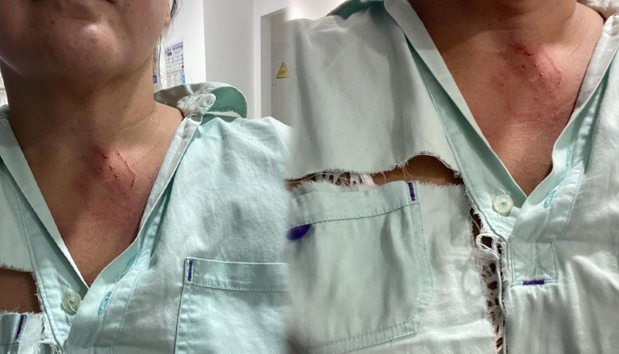 Así quedó la médica después de la agresión.