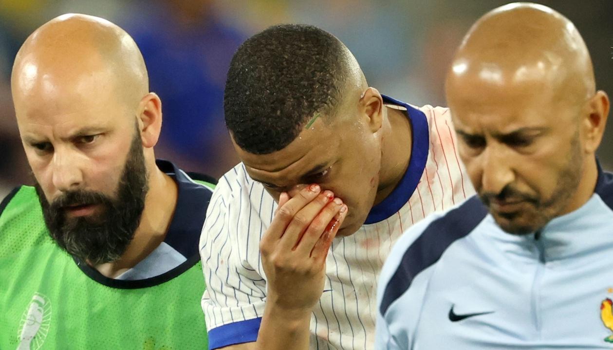 Kylian Mbappé abandona la cancha tras romperse la nariz en el juego contra Austria. 