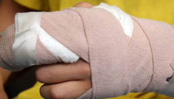 Van 32 menores lesionados con pólvora. 
