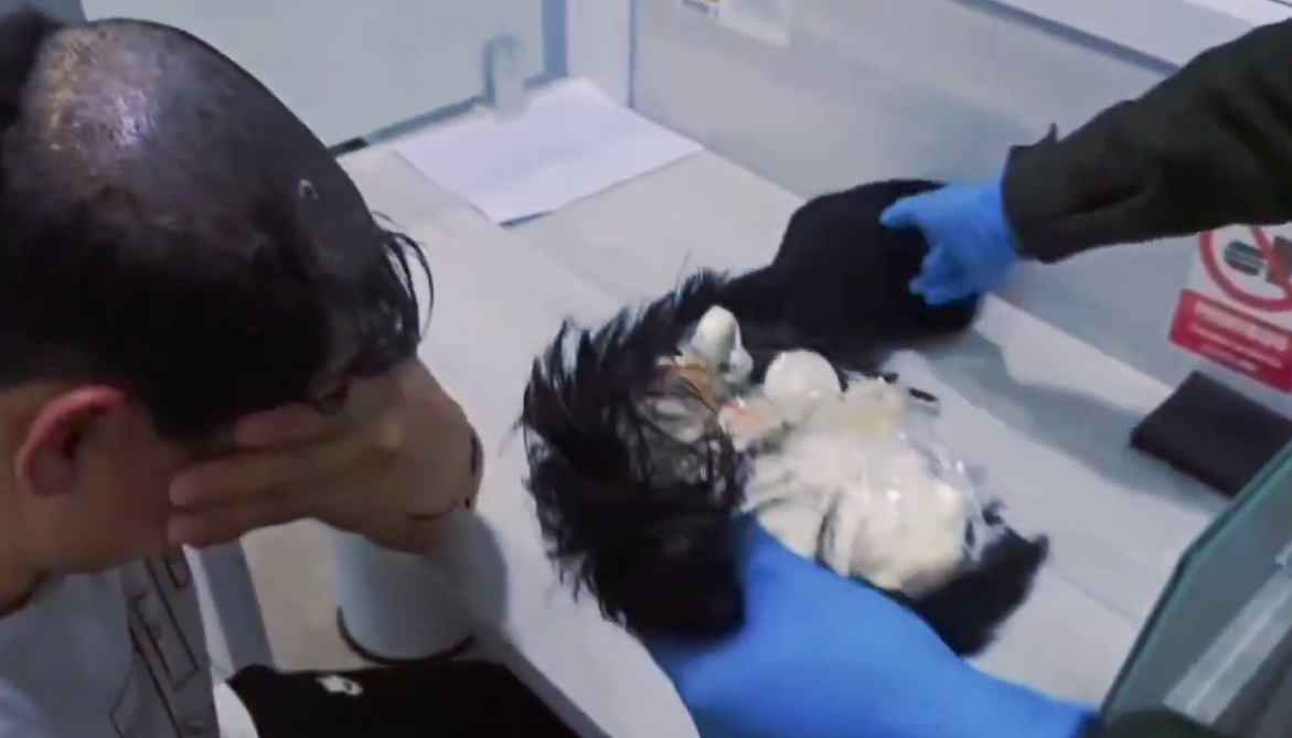 La peluca la llevaba puesta el hombre y allí le descubrieron la droga. 