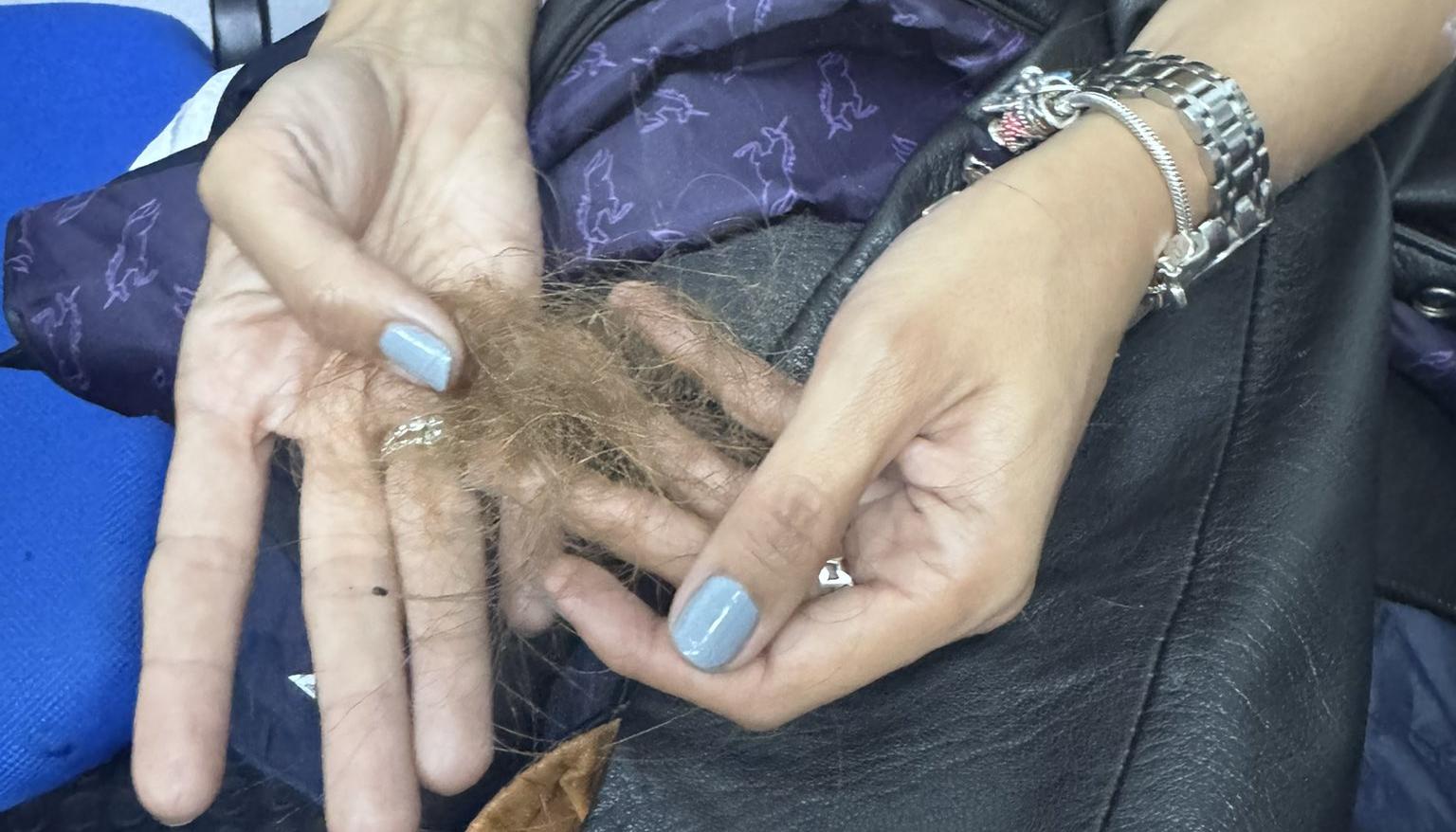 Resultaron con quemaduras en la piel, las manos y el cabello. 