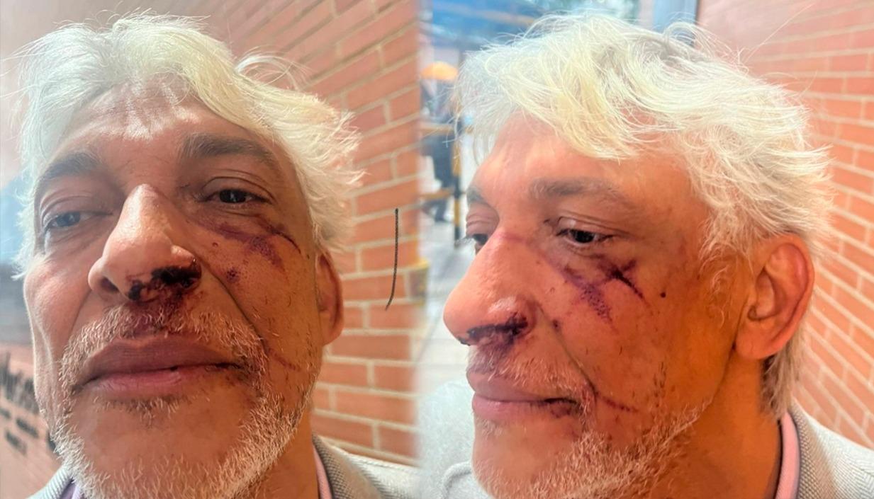 El director de Colombia Compra Eficiente, Cristóbal Padilla.