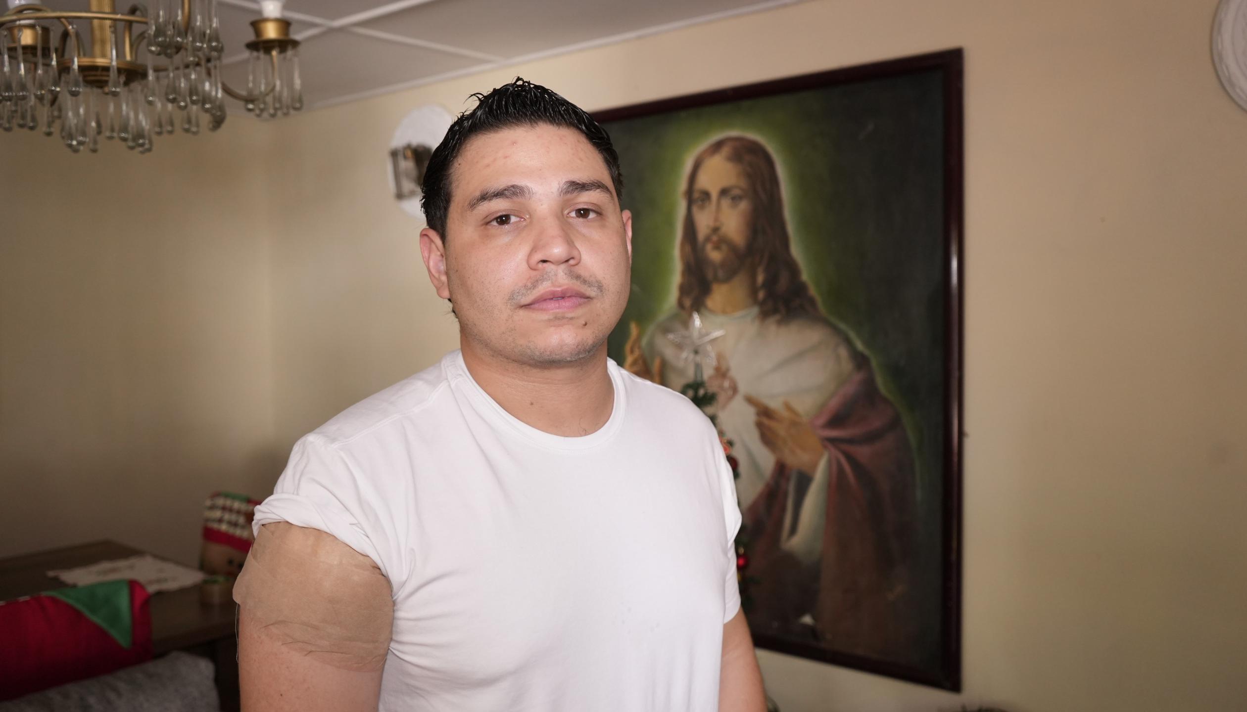 El artista guajiro muestra donde resultó herido en su brazo derecho. 