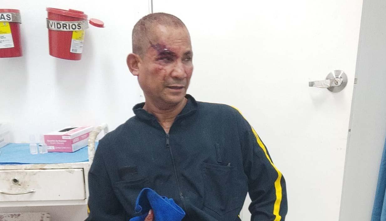 Danián Villamil, vigilante agredido. 