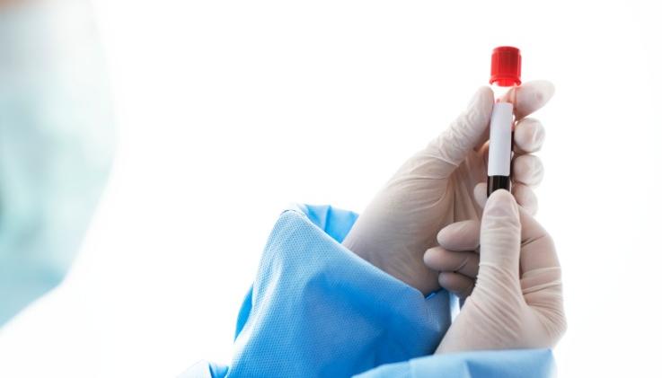 Imagen de referencia.