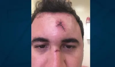 El hombre resultó herido en la frente.