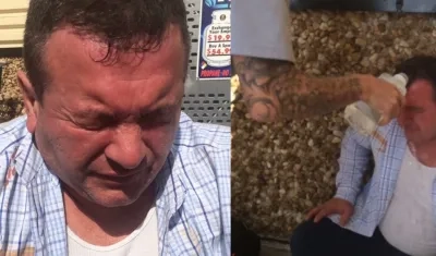 Mario Gallo, el hombre lesionado.