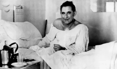 Louis Washkansky contaba con 55 años cuando fue trasplantado.