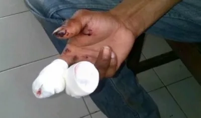 Los dos adultos quemados no tuvieron heridas de gravedad.