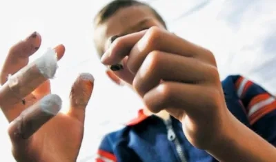 En 2016, también hubo 4 quemados en la Fiesta de Velitas.