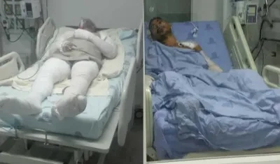 Álvaro Solano, interno que intentó suicidarse, y Francisco Acosta  recluso quemado.