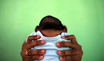 Los niños con microencefalia necesitan mucha atención por su salud.