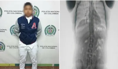 Capturada y radiografía que muestra las cápsulas.