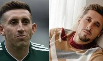 El futbolista mexicano Héctor Herrera antes y después del procedimiento.