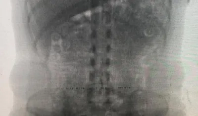 La mujer se enfermó durante el viaje y esto alertó a la Policía.