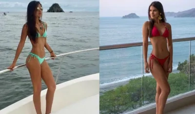 La Señorita Magdalena María Camila Cárdenas Rapelo, antes y después de las cirugías.