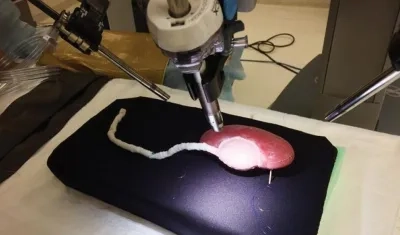 Réplica impresa en tres dimensiones (3D) de un riñón.