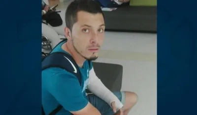 Leonardo Pico se fracturó el brazo izquierdo. 