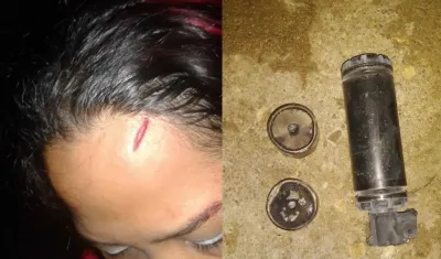  A la izquierda, la esposa del joven detenido resultó herida en la frente. A la derecha, gases lacrimógenos que fueron lanzados por la Policía. 